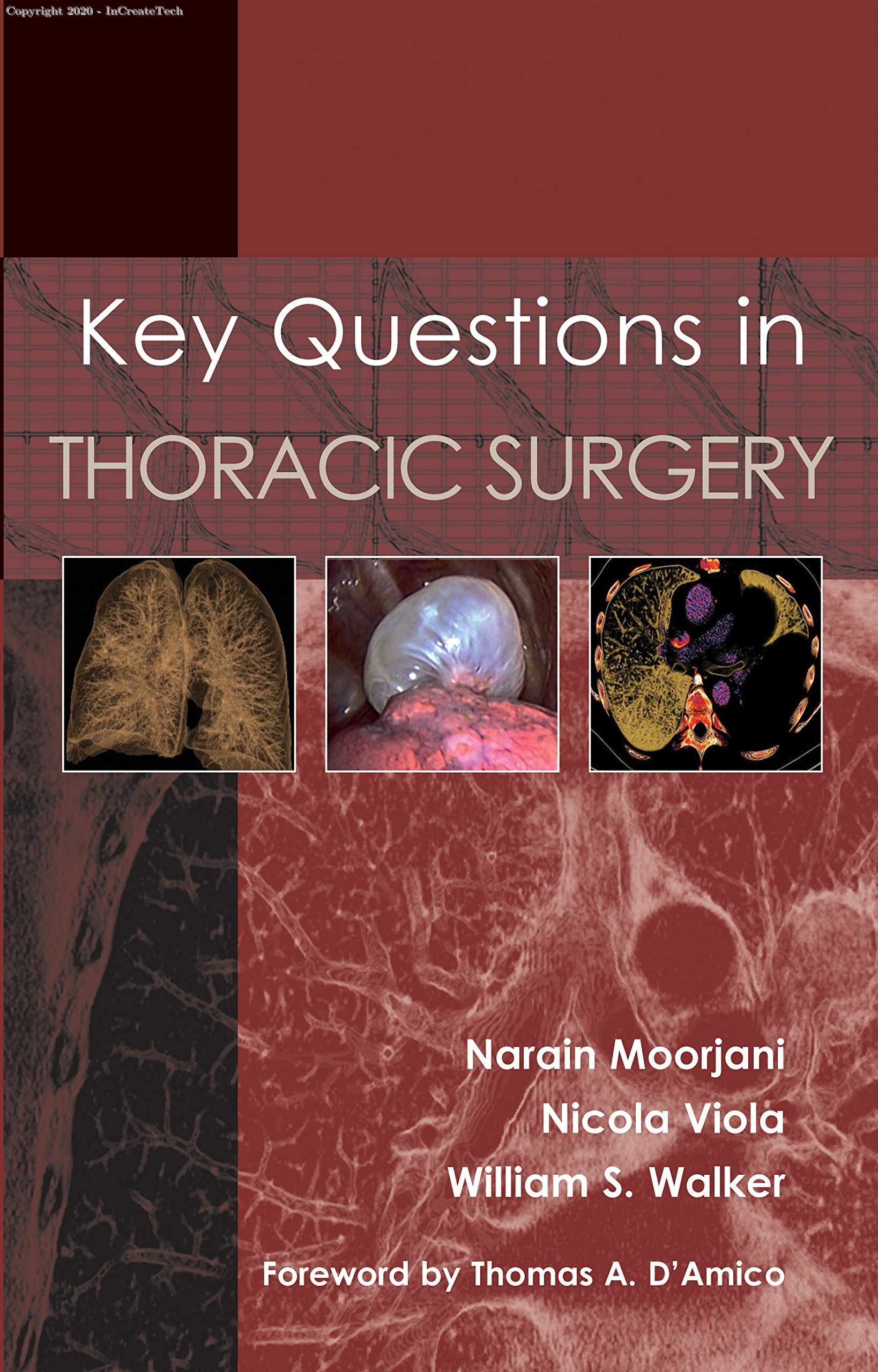 Key Questions in Thoracic Surgery 2VOL SET