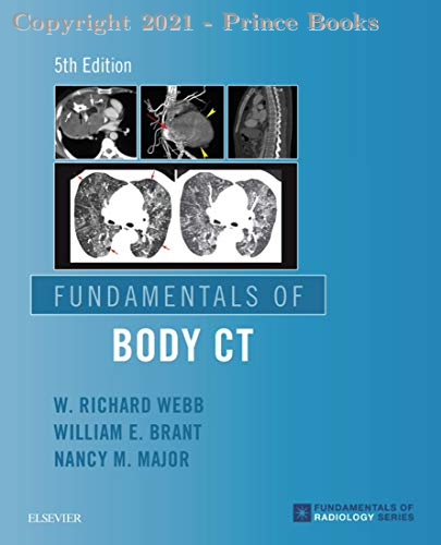 Fundamentals of Body CT, 5e
