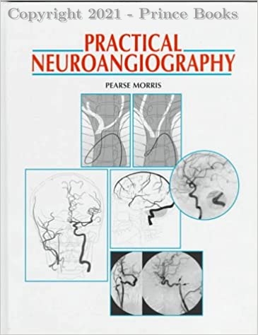Practical Neuroangiography, 1e