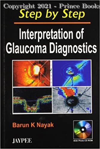 Step by Step Interpreattion of Glaucoma, 6e