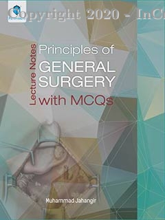 LECTURE NOTES: PRINCIPLES OF GENERAL SURGERY WITH MCQS
