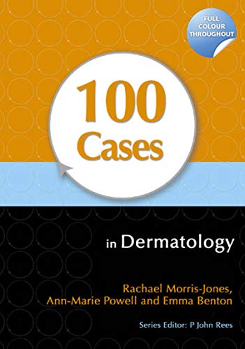 100 Cases in Dermatology, 1e