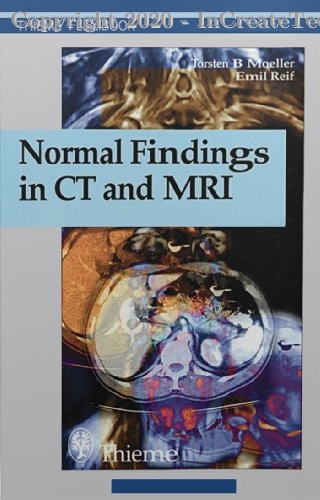 Normal Findings in CT and MRI, 1e