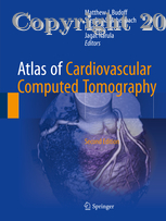 Atlas of Cardiovascular Computed Tomography, 2e