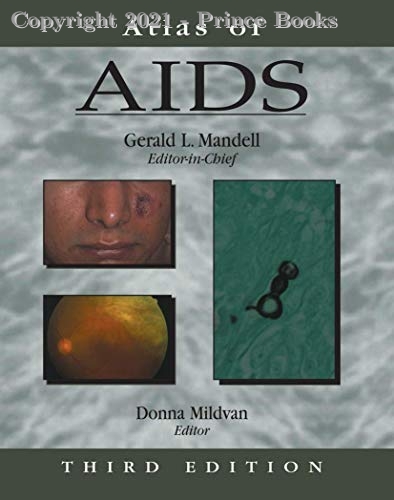 Atlas of AIDS, 3E