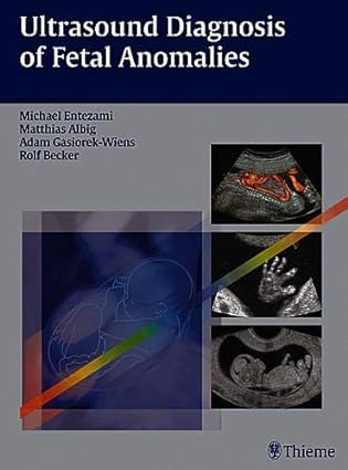 Ultrasound Diagnosis of Fetal Anomalies, 1e