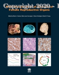 WHO Classification of Tumours of Female Reproductive Organs WHO Classification of Tumours, 4E