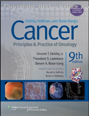 cancer principles & practice of oncology, 9e