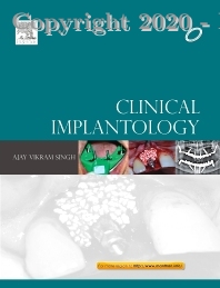 Clinical Implantology 1st Edition