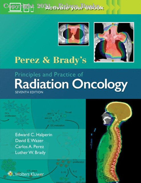 perez & brady's principles and practice of radiation oncology 3 VOL SET, 7E