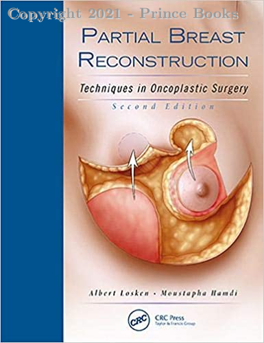 Partial Breast Reconstruction Techniques in Oncoplastic Surgery, 2E