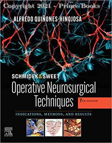 SChmidek and Sweet Operative Neurosurgical Techniques 3vol set, 7e