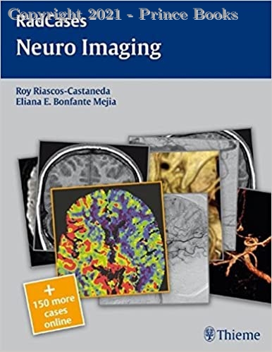 radcases neuro imaging, 1e