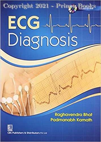 Ecg Diagnosis