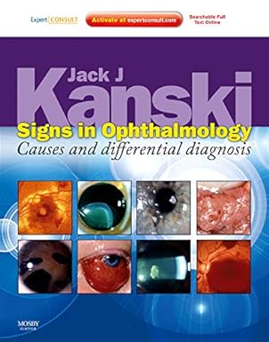 Signs in Ophthalmology: Causes and Differential Diagnosis: Expert Consult, 1e