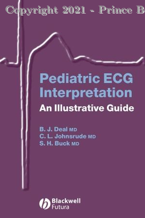 Pediatric ECG Interpretation An Illustrative Guide