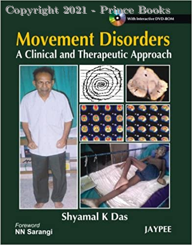 Movement Disorders A Clinical and Therapeutic Approach
