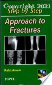 Step by Step Approach To Fractures, 4e