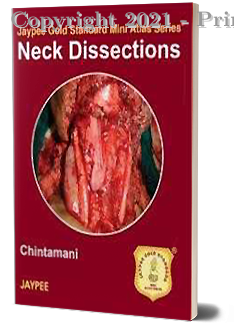 Neck Dissections