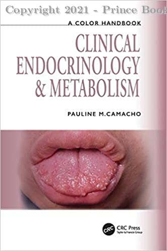 A COLOR HANDBOOK Clinical Endocrinology and Metabolism, 1E