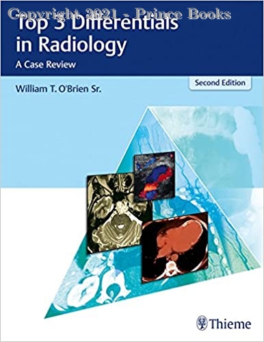 Top 3 Differentials in Radiology, 2e