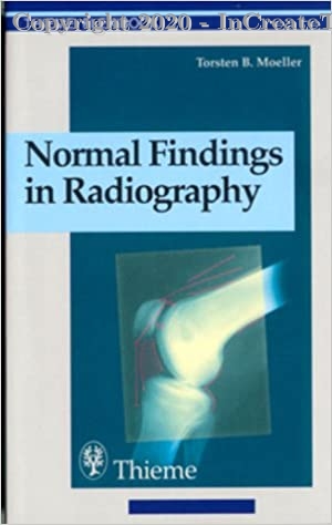 Normal Findings in Radiography, 1e