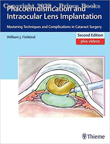 Phacoemulsification and Intraocular Lens Implantation, 2E