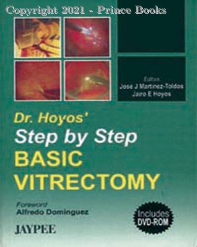 Dr. Hoyos' Step by Step Basic Vitrectomy