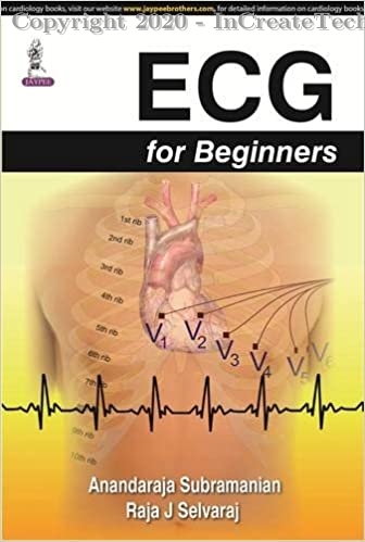Ecg For Beginners, 1e