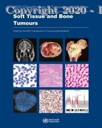 Soft Tissue and Bone Tumours: WHO Classification of Tumours