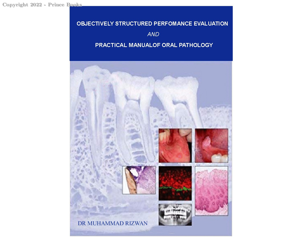 OBJECTIVELY STRUCTURED PERFORMANCE EVALUATION AND PRACTICAL MANUAL OF ORAL PATHOLOGY