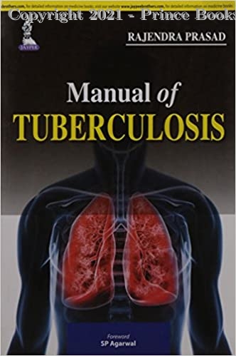 Manual Of Tuberculosis, 1e