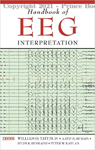 Handbook of EEG Interpretation, 1e