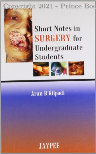 Short Notes in Surgery for Undergraduates Students