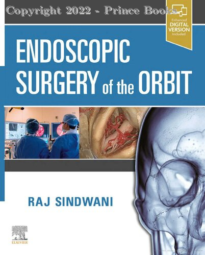 Endoscopic Surgery of the Orbit, 1E