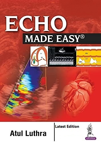 Echo Made Easy, 5E