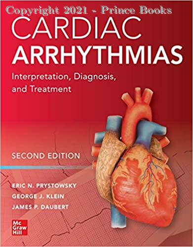 Cardiac arrhythmias interpretation, diagnosis, and treatment, 2e