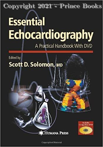 Essential Echocardiography: A practical handbook, 1e