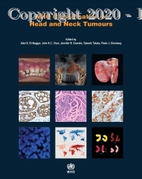 WHO Classification of Head and Neck Tumours, 4e