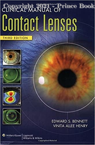 Clinical Manual of Contact Lenses, 3e