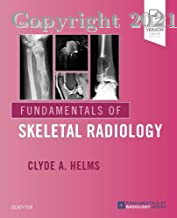 Fundamentals of Skeletal Radiology