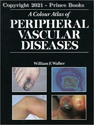 A Colour Atlas of Peripheral Vascular Diseases