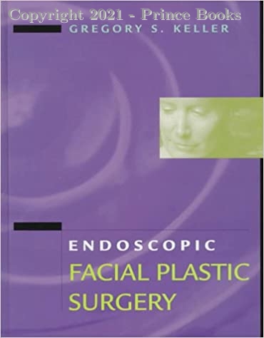 Endoscopic Facial Plastic Surgery, 1e