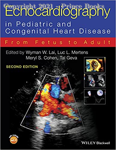 Echocardiography in Pediatric and Congenital Heart Disease 2 VOL SET, 2e