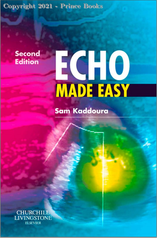 Echo Made Easy, 2E
