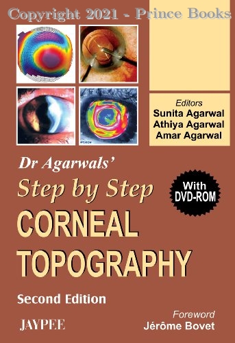 Dr. Agarwal's Step by Step Corneal Topography