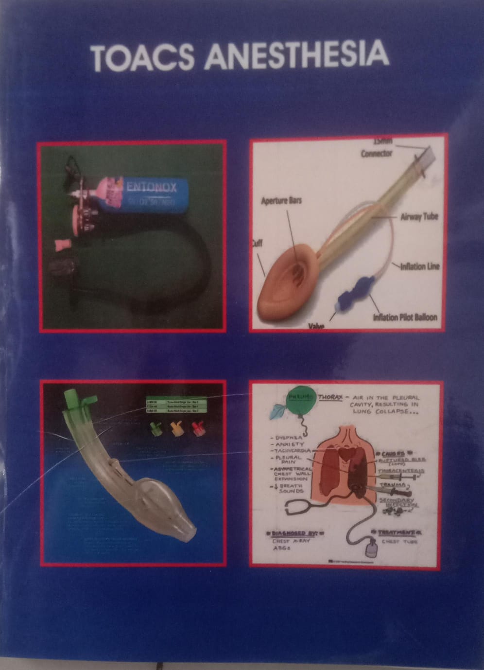 34090473 - toacs anesthesia 1 E