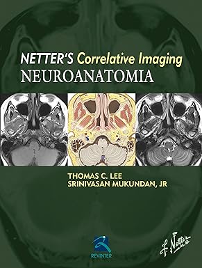 Neuroanatomia Netter's. Correlative Imaging, 1e
