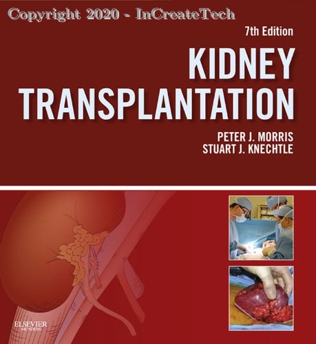 Kidney Transplantation, 7e