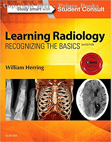 Learning Radiology Recognizing the Basics, 3e